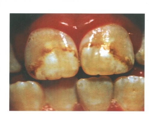 Teeth image