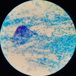 wastewater microbes beneath a scope