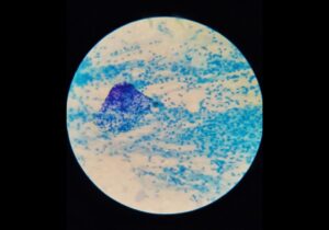 Microbes within wastewater sample