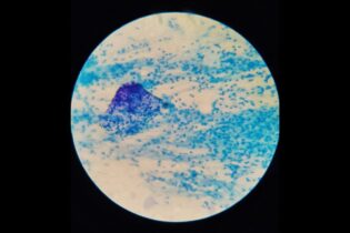 Microbes within wastewater sample