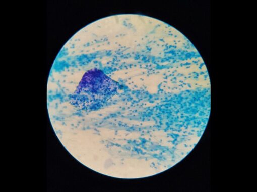 Microbes within wastewater sample